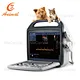 Ultrasonic Diagnostic Scanner